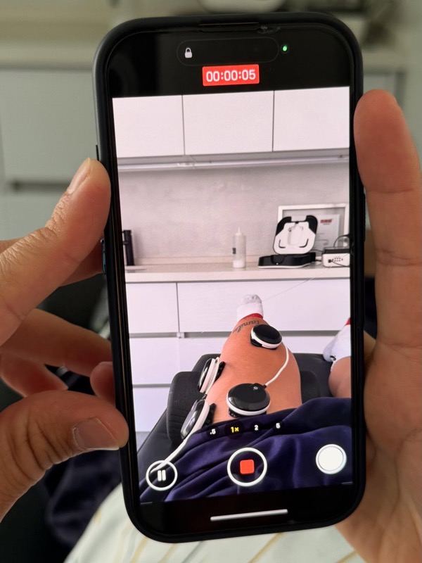 Equipo de crioterapia CryoPush en uso en HÖK